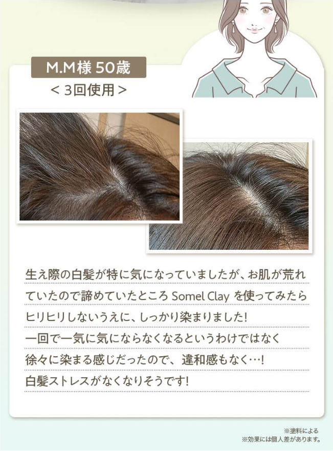 生え際のケア散髪のついででしっかりと